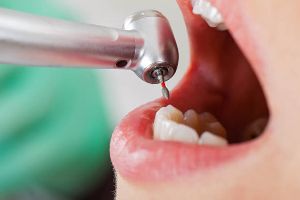 Best Dentist Open Late Near Me  in Camp Barrett, VA